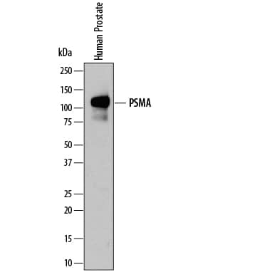 Western blot shows lysates of human prostate tissue. PVDF membrane was probed with 0.2 µg/mL of Sheep Anti-Human PSMA/FOLH1/ NAALADase I Antigen Affinity-purified Poly-clonal Antibody (Catalog # AF4234) followed by HRP-conjugated Anti-Sheep IgG Secondary Antibody (Catalog # HAF016). A specific band was detected for PSMA/FOLH1/NAALADase I at approximately 120 kDa (as indicated). This experiment was conducted under reducing conditions and using Immunoblot Buffer Group 1.