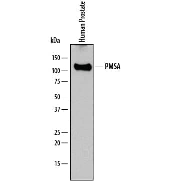Western blot shows lysates of human prostate tissue. PVDF membrane was probed with 2 µg/mL of Mouse Anti-Human PSMA/FOLH1/NAALADase I Monoclonal Antibody (Catalog # MAB4234) followed by HRP-conjugated Anti-Mouse IgG Secondary Antibody (Catalog # HAF007). A specific band was detected for NAALADase I at approximately 120 kDa (as indicated). This experiment was conducted under reducing conditions and using Immunoblot Buffer Group 1.
