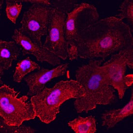 NAALADase I was detected in immersion fixed PC-3 human prostate cancer cell line using Mouse Anti-Human PSMA/FOLH1/ NAALADase I Monoclonal Antibody (Catalog # MAB4234) at 10 µg/mL for 3 hours at room temperature. Cells were stained using the NorthernLights™ 557-conjugated Anti-Mouse IgG Secondary Antibody (red; Catalog # NL007) and counterstained with DAPI (blue). Specific staining was localized to cell surfaces and cytoplasm. View our protocol for Fluorescent ICC Staining of Cells on Coverslips.