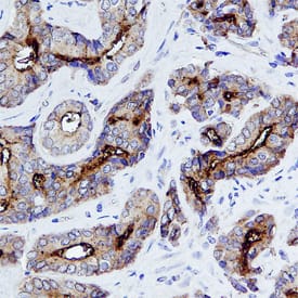 NAALADase I was detected in formalin fixed paraffin-embedded sections of human prostate using Mouse Anti-Human PSMA/FOLH1/NAALADase I Monoclonal Antibody (Catalog # MAB4234) at 1 µg/mL overnight at 4 °C. Tissue was stained using the Anti-Mouse HRP-DAB Cell & Tissue Staining Kit (brown; Catalog # CTS002) and counterstained with hematoxylin (blue). Specific staining was localized to glandular epithelial cells. View our protocol for Chromogenic IHC Staining of Paraffin-embedded Tissue Sections.