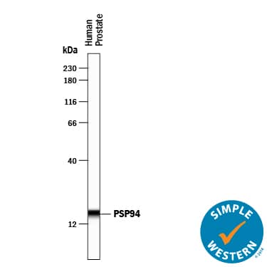 Simple Western lane view shows lysates of human prostate tissue, loaded at 0.2 mg/mL. A specific band was detected for PSP94/MSMB at approximately 17 kDa (as indicated) using 10 µg/mL of Goat Anti-Human PSP94/MSMB Antigen Affinity-purified Polyclonal Antibody (Catalog # AF3780) followed by 1:50 dilution of HRP-conjugated Anti-Goat IgG Secondary Antibody (Catalog # HAF109). This experiment was conducted under reducing conditions and using the 12-230 kDa separation system.