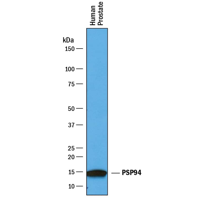 Western blot shows lysates of human prostate tissue. PVDF membrane was probed with 1 µg/mL of Goat Anti-Human PSP94/MSMB Antigen Affinity-purified Polyclonal Antibody (Catalog # AF3780) followed by HRP-conjugated Anti-Goat IgG Secondary Antibody (Catalog # HAF019). A specific band was detected for PSP94/MSMB at approximately 13 kDa (as indicated). This experiment was conducted under reducing conditions and using Immunoblot Buffer Group 1.