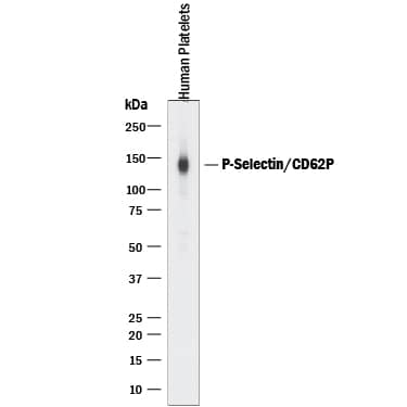 Western Blot P-Selectin/CD62P Antibody [Unconjugated]