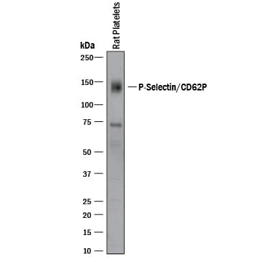 Western Blot P-Selectin/CD62P Antibody [Unconjugated]