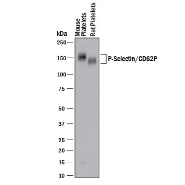 Western Blot P-Selectin/CD62P Antibody [Unconjugated]
