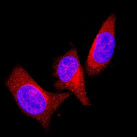 PTEN was detected in immersion fixed Neuro-2A mouse neuroblastoma cell line using Goat Anti-Human PTEN Antigen Affinity-purified Polyclonal Antibody (Catalog # AF6655) at 1.7 µg/mL for 3 hours at room temperature. Cells were stained using the NorthernLights™ 557-conjugated Anti-Goat IgG Secondary Antibody (red; Catalog # NL001) and counterstained with DAPI (blue). Specific staining was localized to cytoplasm. View our protocol for Fluorescent ICC Staining of Cells on Coverslips.
