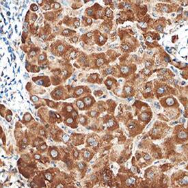 PTEN was detected in immersion fixed paraffin-embedded sections of human liver using Goat Anti- Human PTEN Antigen Affinity-purified Polyclonal Antibody (Catalog # AF6655) at 10 µg/mL overnight at 4 °C. Before incubation with the primary antibody, tissue was subjected to heat-induced epitope retrieval using Antigen Retrieval Reagent-Basic (Catalog # CTS013). Tissue was stained using the Anti-Goat HRP-DAB Cell & Tissue Staining Kit (brown; Catalog # CTS008) and counterstained with hematoxylin (blue). Specific staining was localized to cytoplasm of hepatocytes. View our protocol for Chromogenic IHC Staining of Paraffin-embedded Tissue Sections.