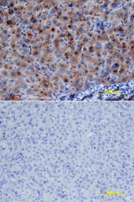 PTEN was detected in immersion fixed paraffin-embedded sections of human liver array using Mouse Anti-Human/Mouse PTEN Monoclonal Antibody (Catalog # MAB847) at 25 µg/mL overnight at 4 °C. Tissue was stained using the Anti-Mouse HRP-DAB Cell & Tissue Staining Kit (brown; Catalog # CTS002) and counterstained with hematoxylin (blue). Lower panel shows a lack of labeling if primary antibodies are omitted and tissue is stained only with secondary antibody followed by incubation with detection reagents. View our protocol for Chromogenic IHC Staining of Paraffin-embedded Tissue Sections.
