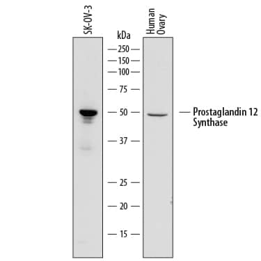 Western Blot Prostaglandin I2 Synthase Antibody (852307) [Unconjugated]