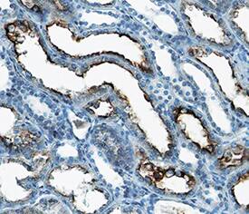 PTH1R/PTHR1 was detected in immersion fixed paraffin-embedded sections of human kidney using Mouse Anti-Human PTH1R/PTHR1 Monoclonal Antibody (Catalog # MAB57091) at 15 µg/mL overnight at 4 °C. Tissue was stained using the Anti-Mouse HRP-DAB Cell & Tissue Staining Kit (brown; Catalog # CTS002) and counterstained with hematoxylin (blue). Specific staining was localized to cytoplasm and plasma membrane in epithelial cells. View our protocol for Chromogenic IHC Staining of Paraffin-embedded Tissue Sections.