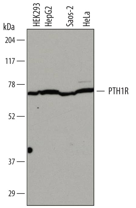 Western blot shows lysates of HEK293 human embryonic kidney cell line, HepG2 human hepatocellular carcinoma cell line, Saos-2 human osteosarcoma cell line, and HeLa human cervical epithelial carcinoma cell line. PVDF membrane was probed with 2 µg/mL of Mouse Anti-Human PTH1R/PTHR1 Monoclonal Antibody (Catalog # MAB5709) followed by HRP-conjugated Anti-Mouse IgG Secondary Antibody (Catalog # HAF007). A specific band was detected for PTH1R/PTHR1 at approximately 68 kDa (as indicated). This experiment was conducted under reducing conditions and using Immunoblot Buffer Group 1.