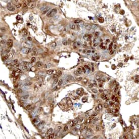 Immunohistochemistry PTHLH/PTHrP Antibody (677939) [Unconjugated]