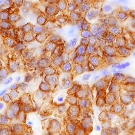Immunohistochemistry PTH Antibody (918462) [Unconjugated]