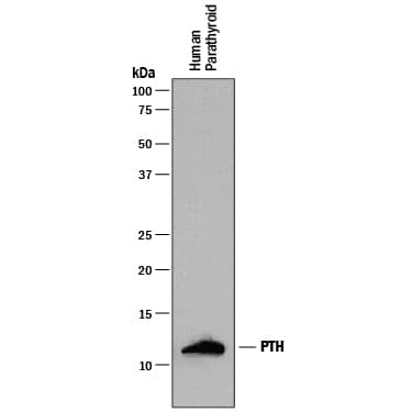 Western Blot PTH Antibody (918462) [Unconjugated]