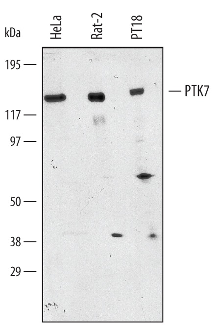Western Blot PTK7/CCK4 Antibody [Unconjugated]