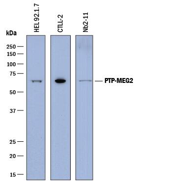Western Blot PTP-MEG2/PTPN9 Antibody