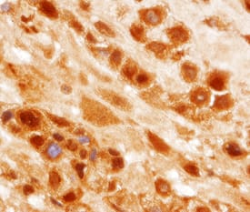 PTPN14 was detected in immersion fixed paraffin-embedded sections of human placenta using Human PTPN14 Monoclonal Antibody (Catalog # MAB4458) at 25 µg/mL overnight at 4 °C. Tissue was stained using the Anti-Mouse HRP-DAB Cell & Tissue Staining Kit (brown; Catalog # CTS002) and counterstained with hematoxylin (blue). View our protocol for Chromogenic IHC Staining of Paraffin-embedded Tissue Sections.