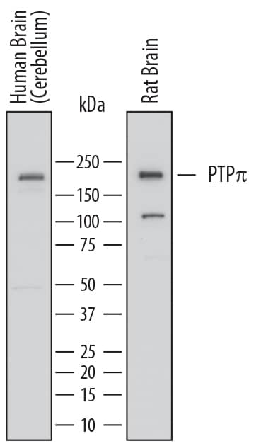 Western Blot PTP pi/PTPRU Antibody (764209)