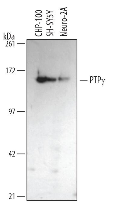 Western blot shows lysates of CHP-100 human neuroblastoma cell line, SH-SY5Y human neuroblastoma cell line, and Neuro-2A mouse neuroblastoma cell line. PVDF membrane was probed with 1 µg/mL of Mouse Anti-Human/Mouse/Rat PTP gamma/PTPRG Monoclonal Antibody (Catalog # MAB4608) followed by HRP-conjugated Anti-Mouse IgG Secondary Antibody (Catalog # <a class=