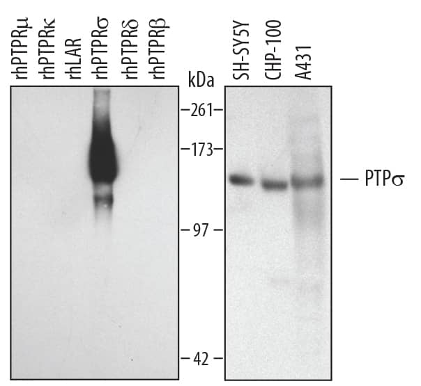 Western Blot PTP sigma/PTPRS Antibody [Unconjugated]