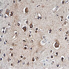 PTP beta /zeta/PTPRZ was detected in immersion fixed paraffin-embedded sections of human brain (cortex) using Rat Anti-Human PTP beta /zeta/PTPRZ Monoclonal Antibody (Catalog # MAB26881) at 15 µg/mL overnight at 4 °C. Tissue was stained using the Anti-Rat HRP-DAB Cell & Tissue Staining Kit (brown; Catalog # CTS017) and counterstained with hematoxylin (blue). Specific staining was localized to neuronal cell bodies. View our protocol for Chromogenic IHC Staining of Paraffin-embedded Tissue Sections.
