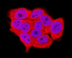 Immunocytochemistry PTP sigma/PTPRS Antibody [Unconjugated]