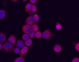 PU.1 was detected in immersion fixed THP-1 human acute monocytic leukemia cell line using Human PU.1 Antigen Affinity-purified Polyclonal Antibody (Catalog # AF5870) at 10 µg/mL for 3 hours at room temperature. Cells were stained using the NorthernLights™ 557-conjugated Anti-Sheep IgG Secondary Antibody (red; Catalog # NL010) and counterstained with DAPI (blue). Specific staining was localized to nuclei and cytoplasm. View our protocol for Fluorescent ICC Staining of Non-adherent Cells.