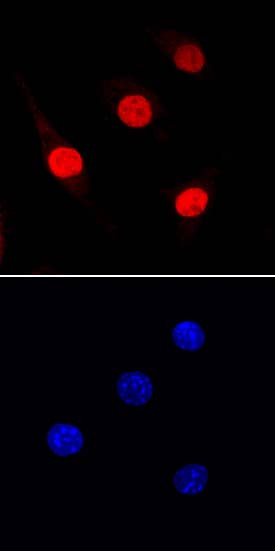 Immunocytochemistry PU.1/Spi-1 Antibody (823123)