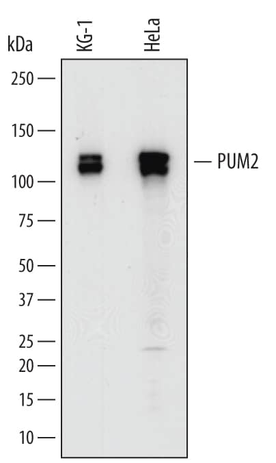 Western blot shows lysates of KG-1 human acute myelogenous leukemia cell line and HeLa human cervical epithelial carcinoma cell line. PVDF membrane was probed with 0.2 µg/mL of Sheep Anti-Human PUM2 Antigen Affinity-purified Polyclonal Antibody (Catalog # AF7415) followed by HRP-conjugated Anti-Sheep IgG Secondary Antibody (Catalog # HAF016). Specific bands were detected for PUM2 at approximately 115-130 kDa (as indicated). This experiment was conducted under reducing conditions and using Immunoblot Buffer Group 1.