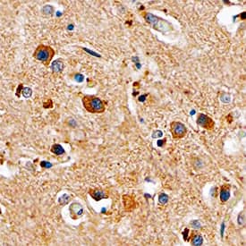 Immunohistochemistry PYK2/FAK2 Antibody