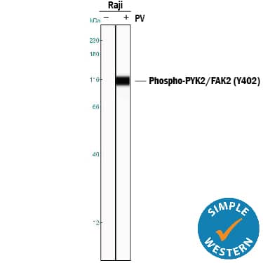 Simple Western PYK2/FAK2 [p Tyr402] Antibody (592918) [Unconjugated]