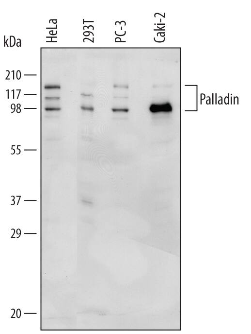 Western blot shows lysates of HeLa human cervical epithelial carcinoma cell line, 293T human embryonic kidney cell line, PC-3 human prostate cancer cell line, and Caki-2 human clear cell carcinoma epithelial cell line. PVDF Membrane was probed with 0.5 µg/mL of Human Palladin Antigen Affinity-purified Polyclonal Antibody (Catalog # AF5950) followed by HRP-conjugated Anti-Sheep IgG Secondary Antibody (HAF016). Specific bands were detected for Palladin at approximately 95, 115, and 140 kDa (as indicated). This experiment was conducted under reducing conditions and using Immunoblot Buffer Group 1.