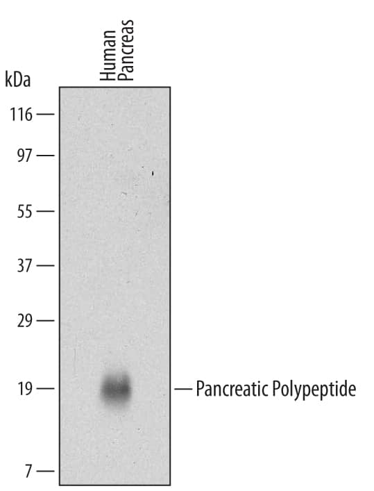 Western blot shows lysates of human pancreas tissue. PVDF Membrane was probed with 2 µg/mL of Human Pancreatic Polypeptide Monoclonal Antibody (Catalog # MAB6297) followed by HRP-conjugated Anti-Mouse IgG Secondary Antibody (Catalog # HAF007). A specific band was detected for Pancreatic Polypeptide at approximately 19 kDa (as indicated). This experiment was conducted under reducing conditions and using Immunoblot Buffer Group 1.