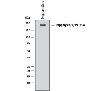 Western blot shows lysate of human pregnant sera. PVDF membrane was probed with 0.1 µg/mL of Goat Anti-Human Pappalysin-1/PAPP-A Antigen Affinity-purified Polyclonal Antibody (Catalog # AF2487) followed by HRP-conjugated Anti-Goat IgG Secondary Antibody (Catalog # HAF017). A specific band was detected for Pappalysin-1/PAPP-A at approximately 200 kDa (as indicated). This experiment was conducted under reducing conditions and using Immunoblot Buffer Group 1.
