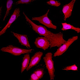 Immunocytochemistry Park7/DJ-1 Antibody [Unconjugated]
