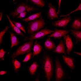Park7/DJ-1 was detected in immersion fixed HeLa human cervical epithelial carcinoma cell line using Mouse Anti-Human/Mouse/Rat Park7/DJ-1 Monoclonal Antibody (Catalog # MAB39951) at 10 µg/mL for 3 hours at room temperature. Cells were stained using the NorthernLights™ 557-conjugated Anti-Mouse IgG Secondary Antibody (red; NL007) and counterstained with DAPI (blue). Specific staining was localized to cytoplasm and nuclei. View our protocol for Fluorescent ICC Staining of Cells on Coverslips.