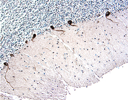 Parkin was detected in immersion fixed paraffin-embedded sections of human brain (cerebellum) using 15 &micro;g/mL Goat Anti-Human Parkin Antigen Affinity-purified Polyclonal Antibody (Catalog # AF1438) overnight at 4 &deg;C. Tissue was stained with the Anti-Goat HRP-DAB Cell & Tissue Staining Kit (brown; Catalog # CTS008) and counterstained with hematoxylin (blue). View our protocol for Chromogenic IHC Staining of Paraffin-embedded Tissue Sections.