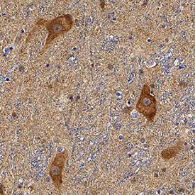 Parkin was detected in immersion fixed paraffin-embedded sections of human brain (substantia nigra) using Mouse Anti-Human Parkin Monoclonal Antibody (Catalog # MAB14382) at 5 µg/mL for 1 hour at room temperature followed by incubation with the Anti-Mouse IgG VisUCyte™ HRP Polymer Antibody (Catalog # VC001). Before incubation with the primary antibody, tissue was subjected to heat-induced epitope retrieval using Antigen Retrieval Reagent-Basic (Catalog # CTS013). Tissue was stained using DAB (brown) and counterstained with hematoxylin (blue). Specific staining was localized to neuronal cell bodies. View our protocol for IHC Staining with VisUCyte HRP Polymer Detection Reagents.