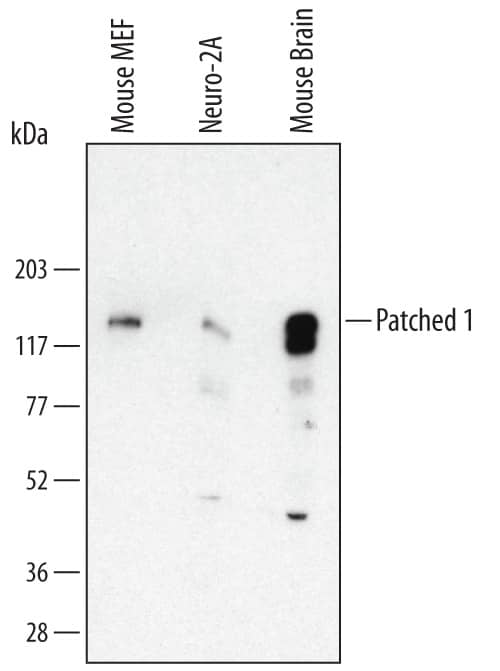 Western Blot Patched 1/PTCH Antibody (413220) [Unconjugated] - (First Extracellular Loop)