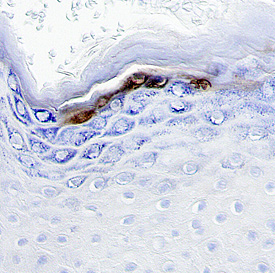 Immunohistochemistry Patched 2/PTCH2 Antibody - (First Extracellular Loop)