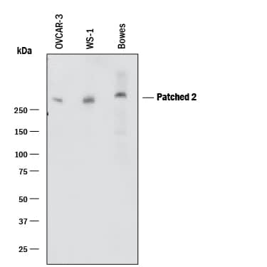 Western blot shows lysates of OVCAR-3 human ovarian carcinoma cell line, WS-1 human fetal skin fibroblast cell line, and Bowes human melanoma cell line. PVDF membrane was probed with 1 µg/mL of Mouse Anti-Human Patched 2/PTCH2 Monoclonal Antibody (Catalog # MAB4078) followed by HRP-conjugated Anti-Mouse IgG Secondary Antibody (Catalog # HAF018). A specific band was detected for Patched 2/PTCH2 at approximately 280 kDa (as indicated). This experiment was conducted under reducing conditions and using Immunoblot Buffer Group 1.