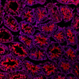 Patched 2/PTCH2 was detected in immersion fixed frozen sections of mouse testis using Rat Anti-Mouse Patched 2/PTCH2 Monoclonal Antibody (Catalog # MAB8096) at 5 µg/mL overnight at 4 °C. Tissue was stained using the NorthernLights™ 557-conjugated Anti-Rat IgG Secondary Antibody (red; Catalog # NL013) and counterstained with DAPI (blue). View our protocol for Fluorescent IHC Staining of Frozen Tissue Sections.