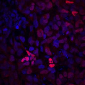 Pax2 was detected in immersion fixed BG01V human embryonic stem cells differentiated into the early otic lineage using Goat Anti-Human Pax2 Antigen Affinity-purified Polyclonal Antibody (Catalog # AF3364) at 10 µg/mL for 3 hours at room temperature. Cells were stained using the NorthernLights™ 557-conjugated Anti-Goat IgG Secondary Antibody (red; NL001) and counterstained with DAPI (blue). Specific staining was localized to nuclei. View our protocol for Fluorescent ICC Staining of Stem Cells on Coverslips.