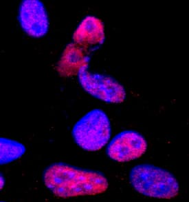 Pax3/Pax7 was detected in immersion fixed B16-F1 mouse melanoma cell line using Mouse Anti-Human/Mouse Pax3/Pax7 Monoclonal Antibody (Catalog # MAB2457) at 2 µg/mL for 3 hours at room temperature. Cells were stained using the NorthernLights™ 557-conjugated Anti-Mouse IgG Secondary Antibody (red; Catalog # NL007) and counterstained with DAPI (blue). Specific staining was localized to nuclei. View our protocol for Fluorescent ICC Staining of Cells on Coverslips.