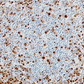 Pax5/BSAP was detected in immersion fixed paraffin-embedded sections of human tonsil using Goat Anti-Human Pax5/BSAP Antigen Affinity-purified Polyclonal Antibody (Catalog # AF3487) at 3 µg/mL overnight at 4 °C. Tissue was stained using the Anti-Goat HRP-DAB Cell & Tissue Staining Kit (brown; Catalog # CTS008) and counterstained with hematoxylin (blue). Specific staining was localized to nuclei in lymphocytes. View our protocol for Chromogenic IHC Staining of Paraffin-embedded Tissue Sections.
