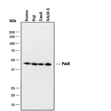 Western blot shows lysates of Ramos human Burkitt's lymphoma cell line, Raji human Burkitt's lymphoma cell line, Daudi human Burkitt's lymphoma cell line, and Nalm-6 human Pre-B acute lymphocytic leukemia cell line. PVDF membrane was probed with 0.5 µg/mL of Goat Anti-Human Pax5/BSAP Antigen Affinity-purified Polyclonal Antibody (Catalog # AF3487) followed by HRP-conjugated Anti-Goat IgG Secondary Antibody (Catalog # HAF017). A specific band was detected for Pax5/BSAP at approximately 47 kDa (as indicated). This experiment was conducted under reducing conditions and using Immunoblot Buffer Group 1.