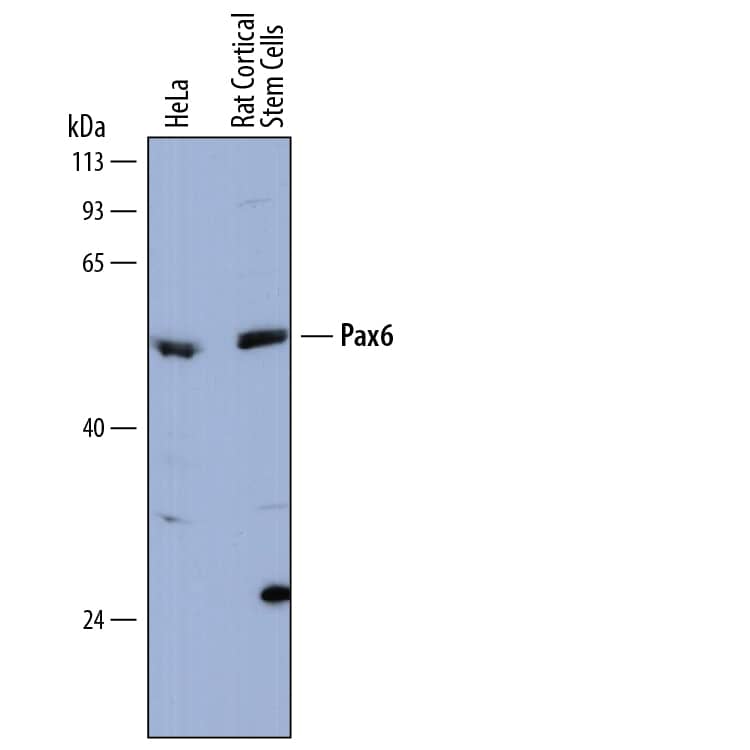 Western Blot Pax6 Antibody [Unconjugated]
