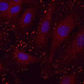 Paxillin was detected in immersion fixed HUVEC human umbilical vein endothelial cells using Mouse Anti-Human Paxillin Monoclonal Antibody (Catalog # MAB4259) at 10 µg/mL for 3 hours at room temperature. Cells were stained using the NorthernLights™ 557-conjugated Anti-Mouse IgG Secondary Antibody (red; Catalog # NL007) and counterstained with DAPI (blue). Specific staining was localized to actin filament tips. View our protocol for Fluorescent ICC Staining of Cells on Coverslips.