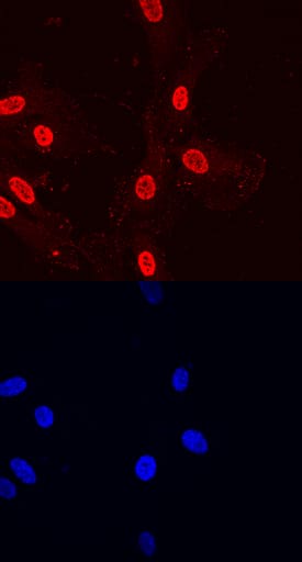 Immunocytochemistry Paxillin [p Tyr31] Antibody (698239) [Unconjugated]