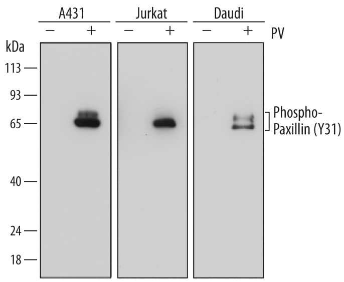 Western Blot Paxillin [p Tyr31] Antibody (698239) [Unconjugated]